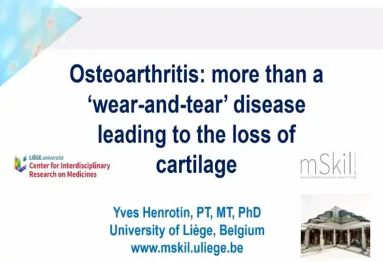 Osteoarthritis more than a wear and tear