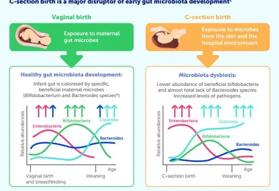 Infographic C-Section Birth and the Infant Gut Microbiota: Nutritional Strategies