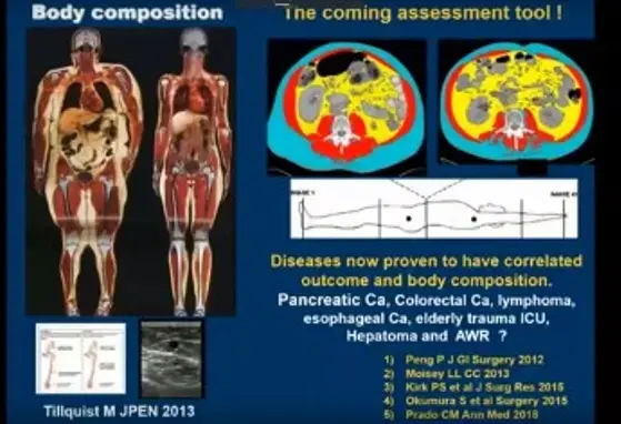 Nutrition in Cancer Therapy: Opportunities for Prevention and Treatment (videos)